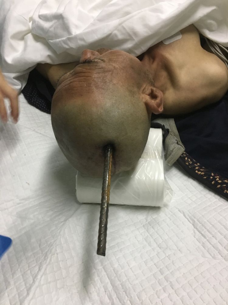 世界首例头颅移植_我的世界空岛刷头颅_我的世界头颅
